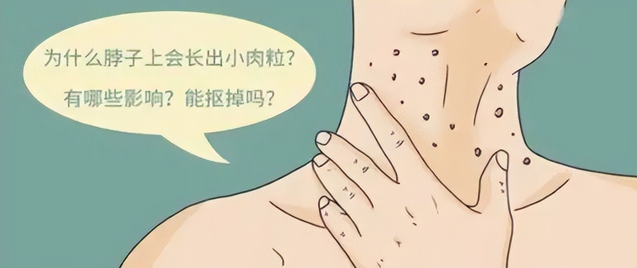 脖子上长小肉粒被自己揪掉了,脖子上的小肉粒揪掉后会怎样