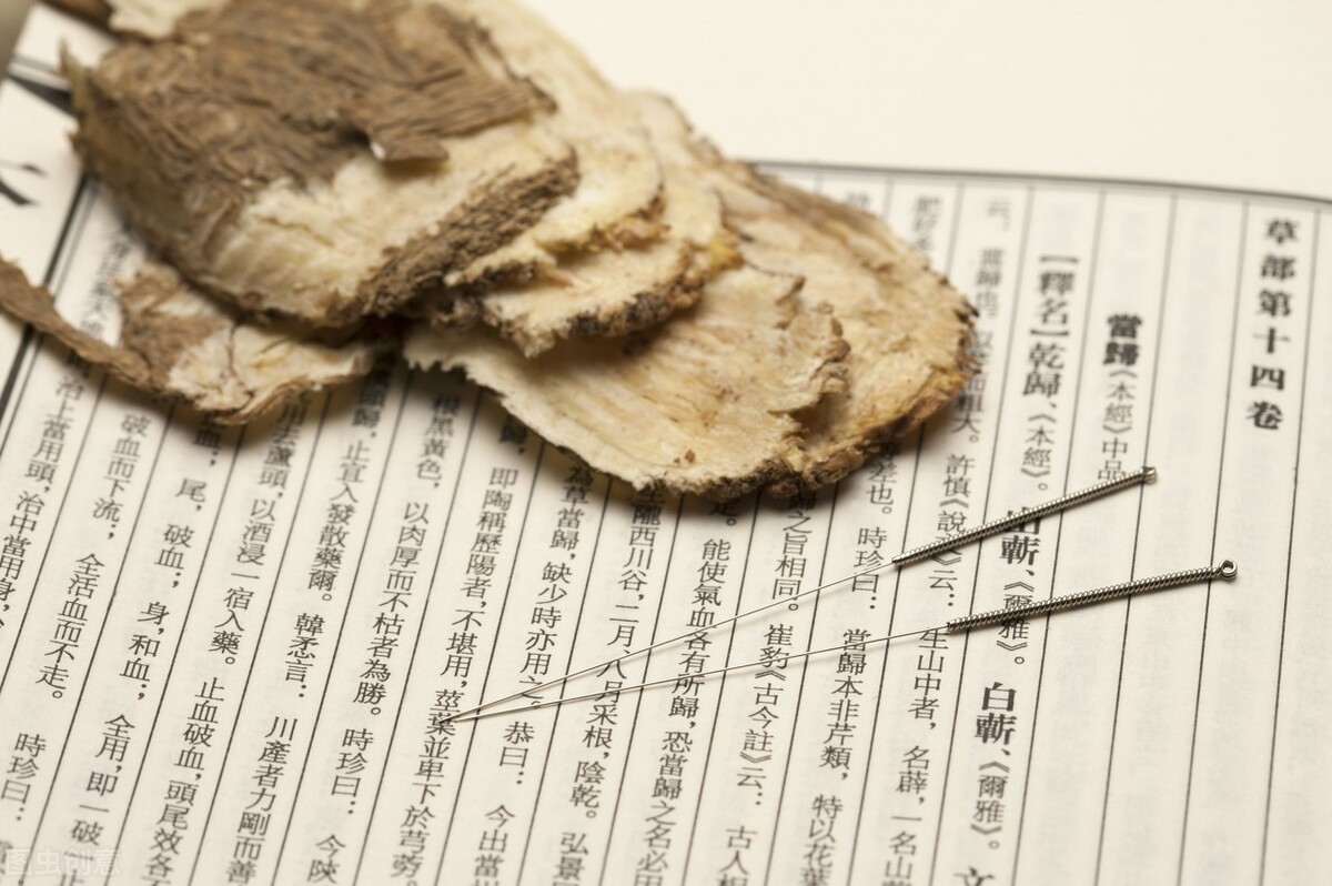 针灸古籍大总结，建议保存收藏，读透一本可成针灸大师