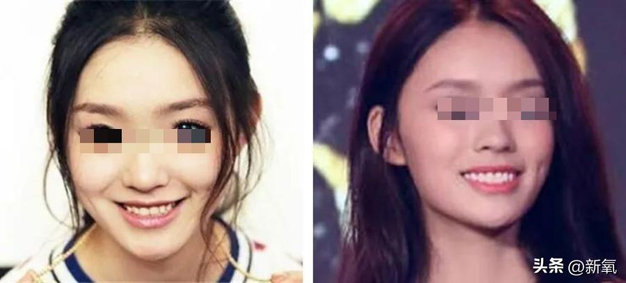 6位一大笑颜值就会崩塌的女明星,看起来笑的很魔性的女明星