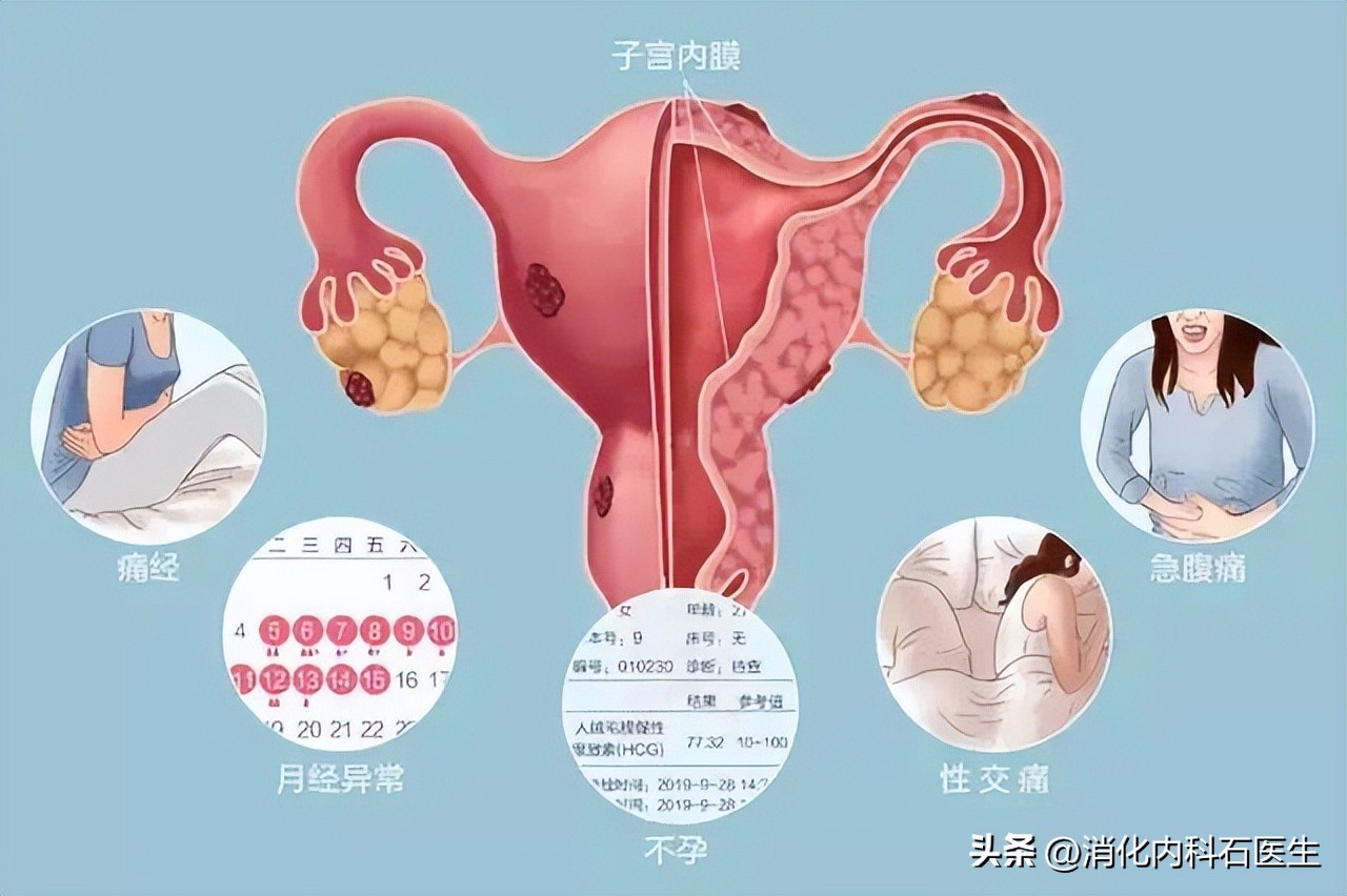 女子新婚之夜舌头出血,影响生活,确诊后女子绝望地走到了19楼顶