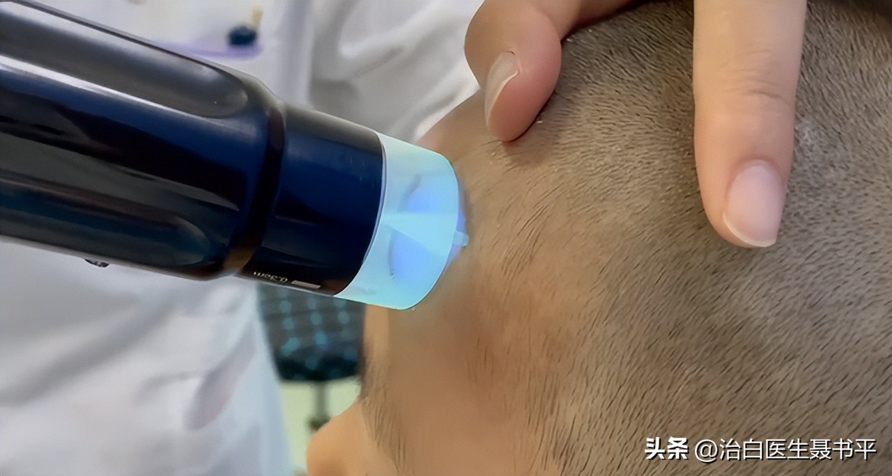 为什么白癜风越来越好治疗了?