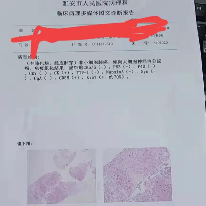 中国人寿防癌险包括哪些癌症,中国人寿癌症保险每年100元