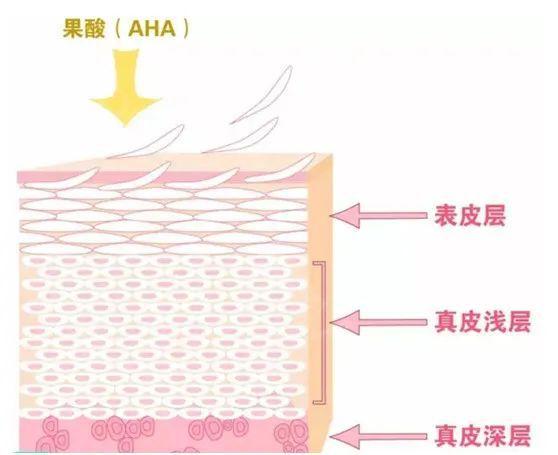您想知道的“刷酸”知识都在这儿！