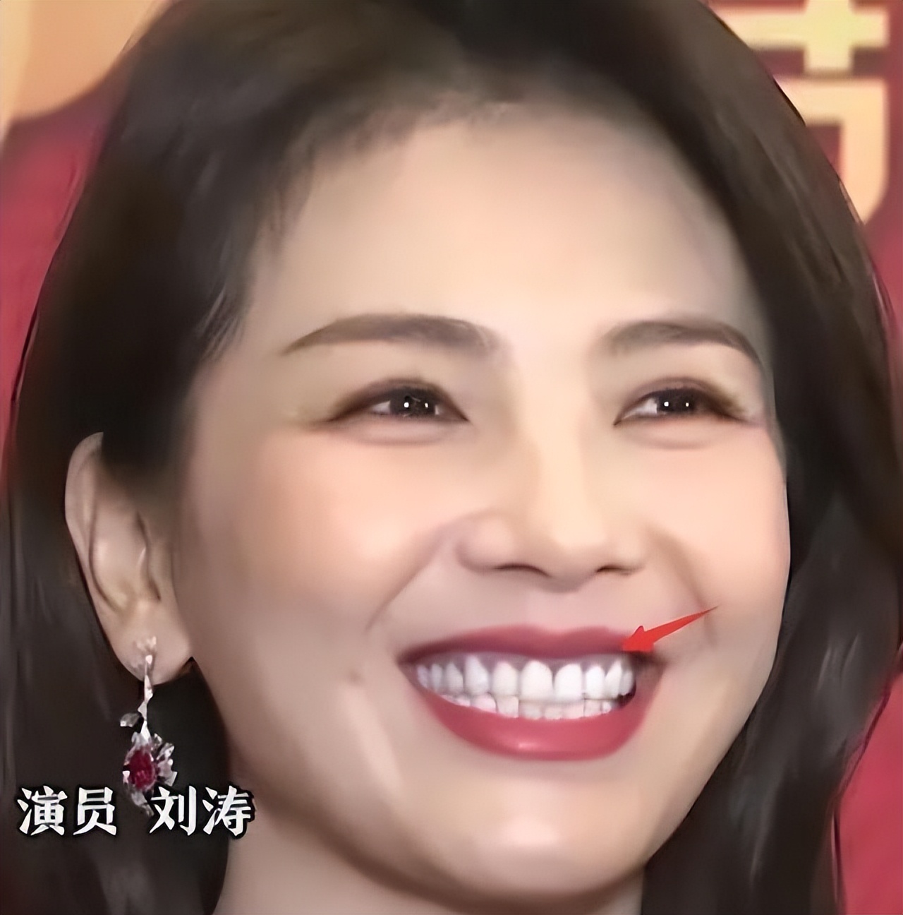 明星做烤瓷牙把真牙去掉吗,明星的烤瓷牙是怎么弄的