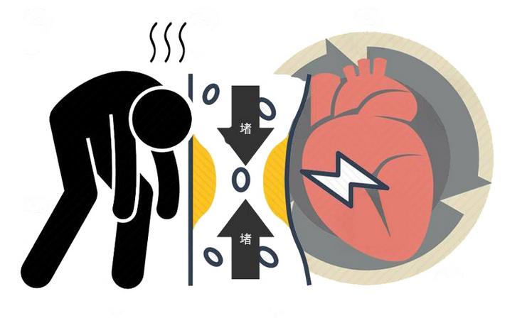 平时不疼不痒，心脏突然疼一下，是心脏病？不一定，或许是这病