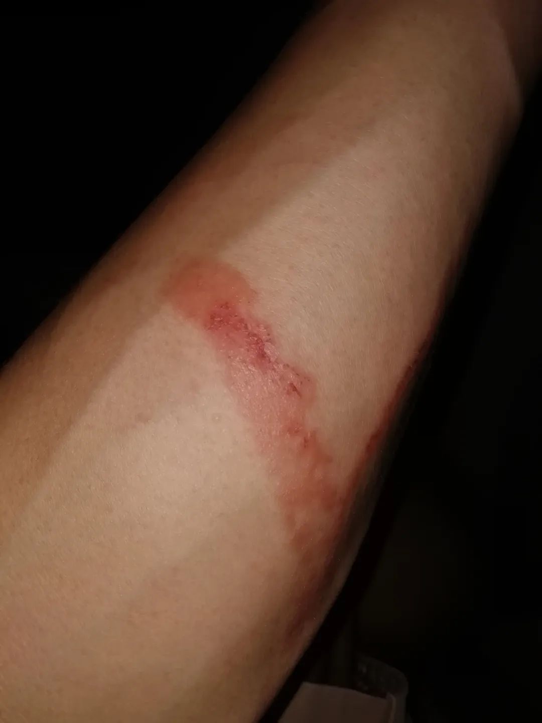 “别动！你手上有条大蜈蚣！”