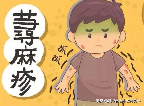 吃了羊肉身体发痒起红包,吃羊肉身上起红疙瘩痒