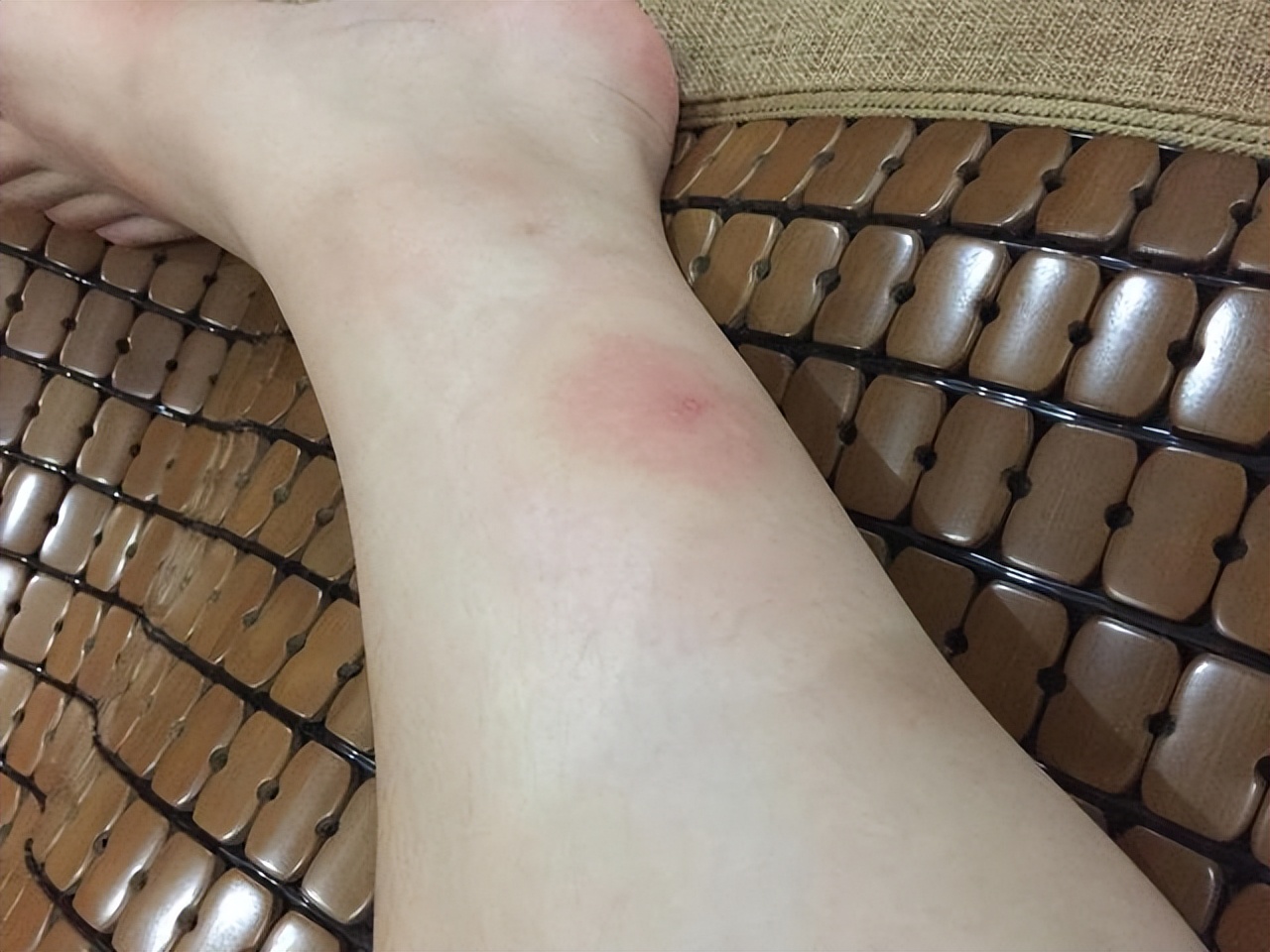 一瓶甲硝唑几块钱，或能帮你改善6种疾病，你会用吗？