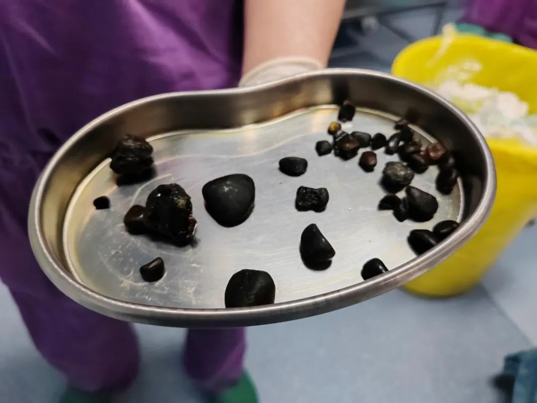 如何判断腰疼是肝痛还是腰肌劳损,肝疼和腰肌劳损疼有哪些不同