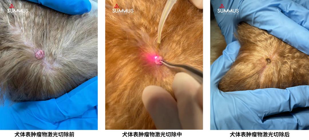 无痛无创疗法，更多医院的选择，SUMMUS全系列产品你喜欢哪个？