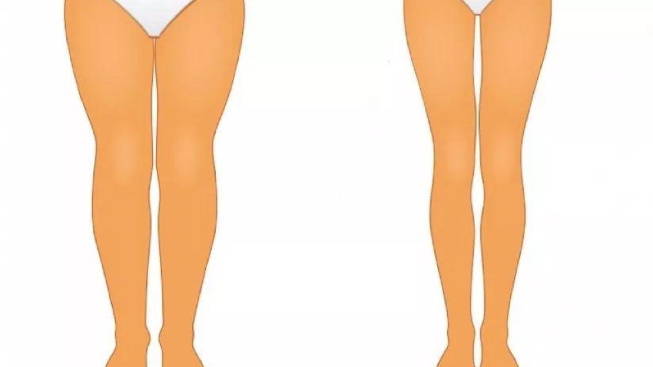 腿变细是预示身体什么病,腿型对腿粗细的影响