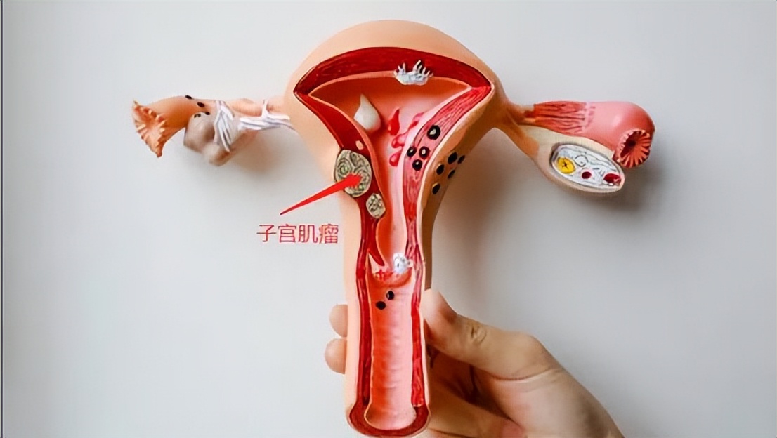 绝经后切除子宫对身体有什么影响,子宫切除后有什么影响