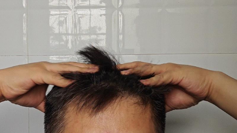 拯救头发大作战,保护头发的大作战