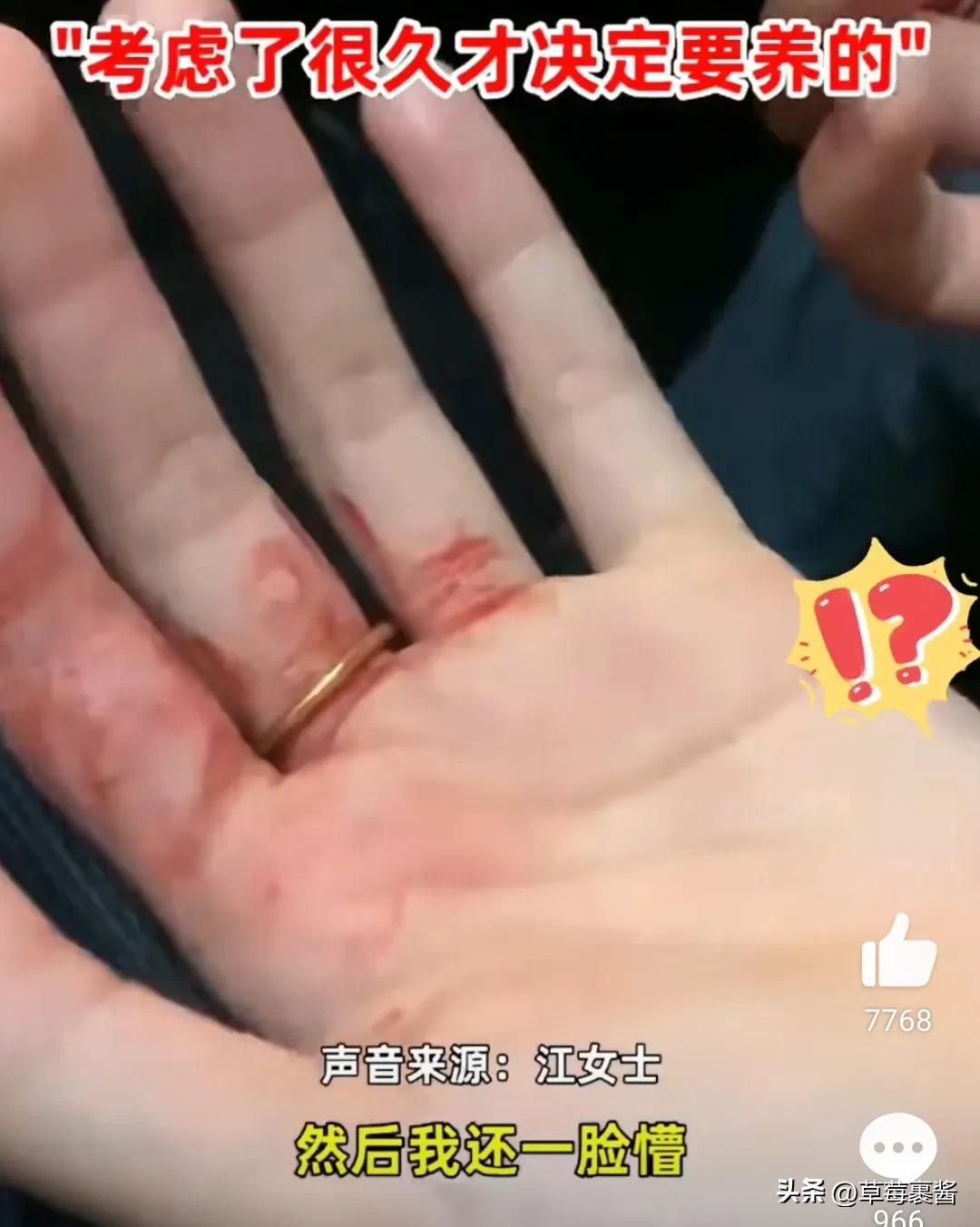 买仓鼠被咬花1000元,一女子买仓鼠被仓鼠咬了