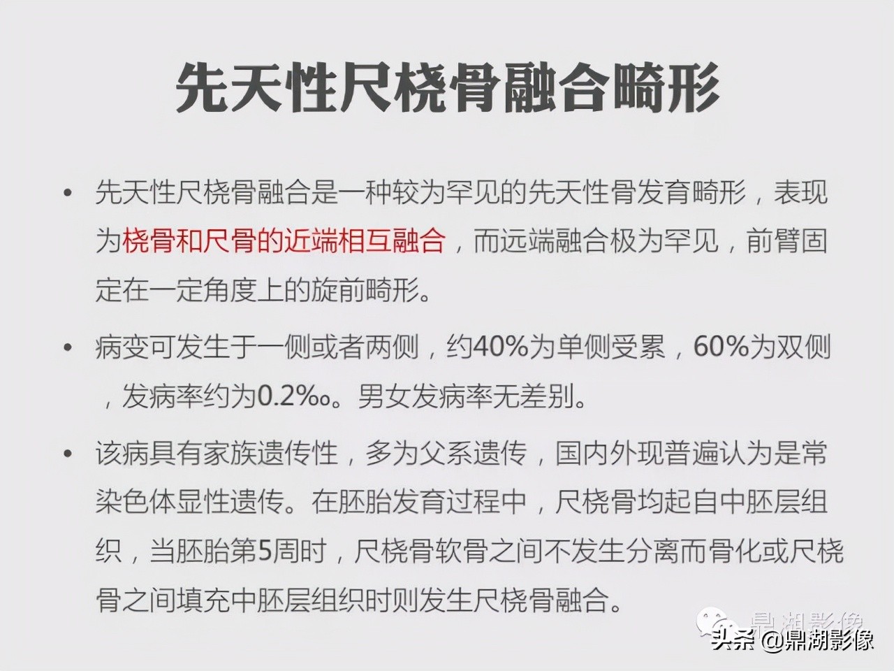 先天桡骨缺失畸形能治疗吗,先天性桡骨发育不良