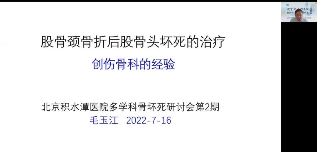 北京积水潭股骨头坏死二期专家,积水潭医院股骨头坏死宣传讲座