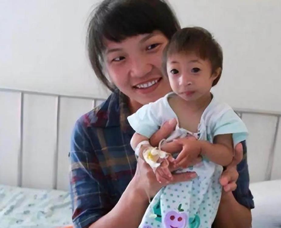 湖南一产妇生下“小猴子”,湖南产妇生下猴女孩上节目