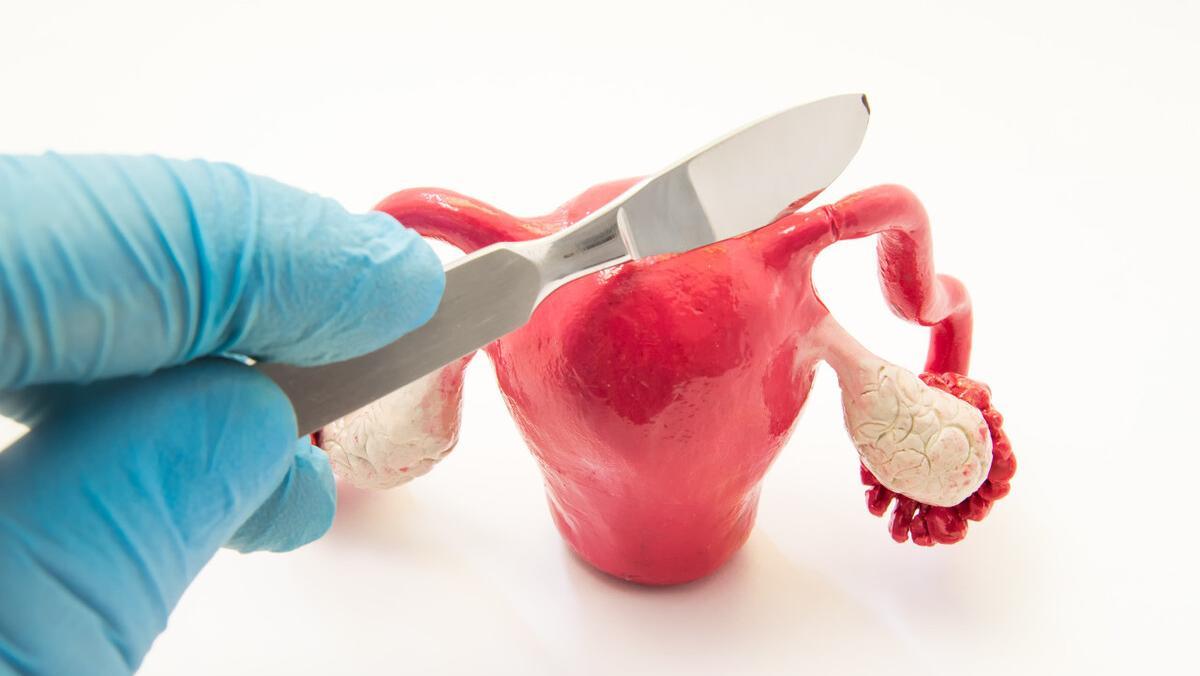 绝经后切除子宫对身体有什么影响,子宫切除后有什么影响