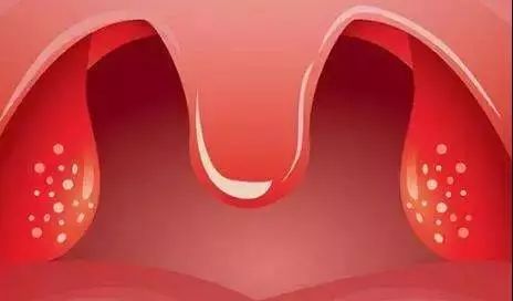 喝水像咽刀子怎么办,喝水像吞刀子为什么