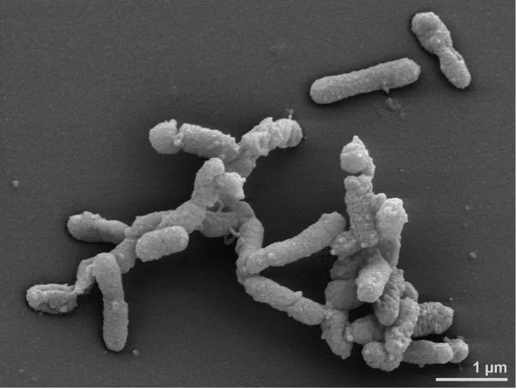 肠道菌群中占大多数的是拟杆菌 (肠杆菌中最常见的环境菌属)