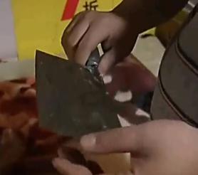 重庆一妇女肚子巨大,女子肚大如球竟是5颗肿瘤