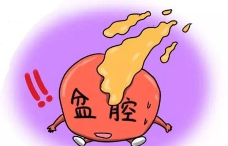 盆腔炎的日常保健对策,盆腔炎真的很可怕吗