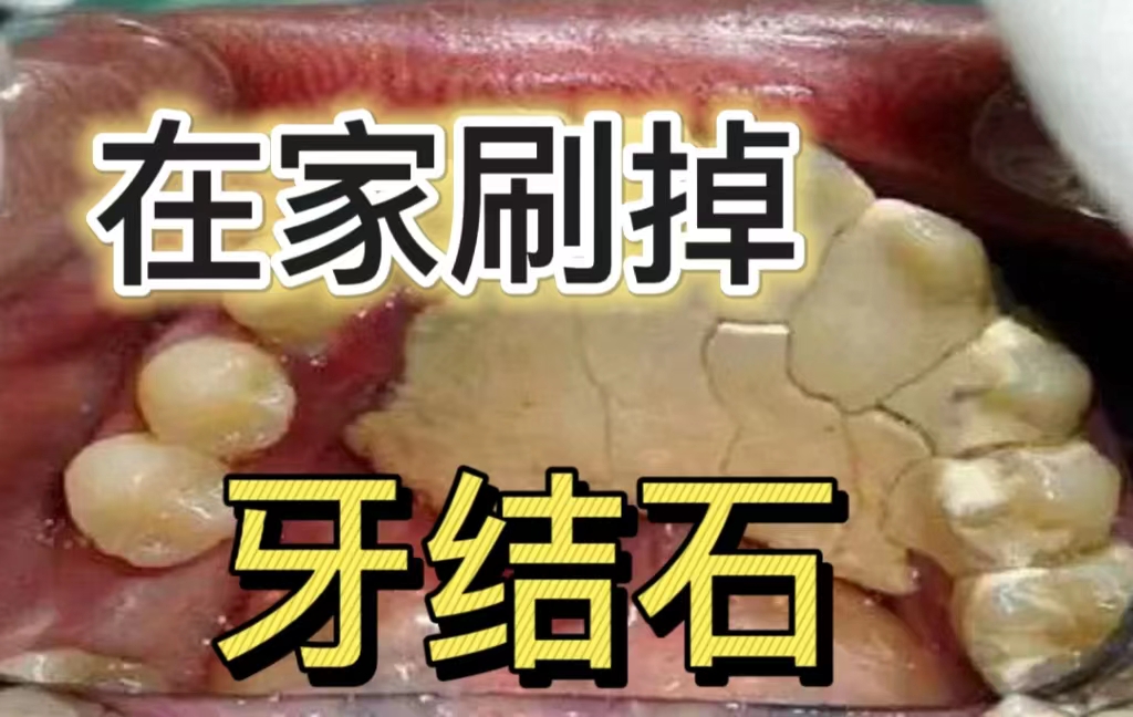 老国货牙粉美白,便宜管用的国货牙粉