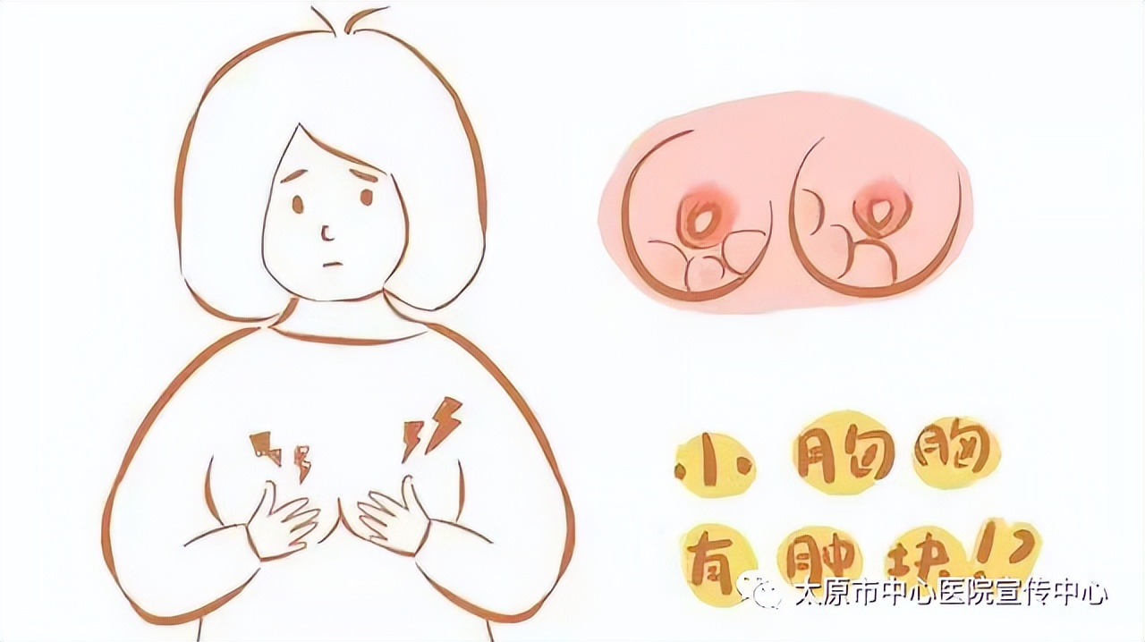 微波消融术可以治乳腺癌吗,乳腺结节微波消融术多少钱一次