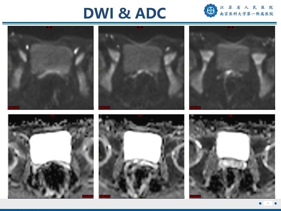 好文分享——《胚胎型横纹肌肉瘤》