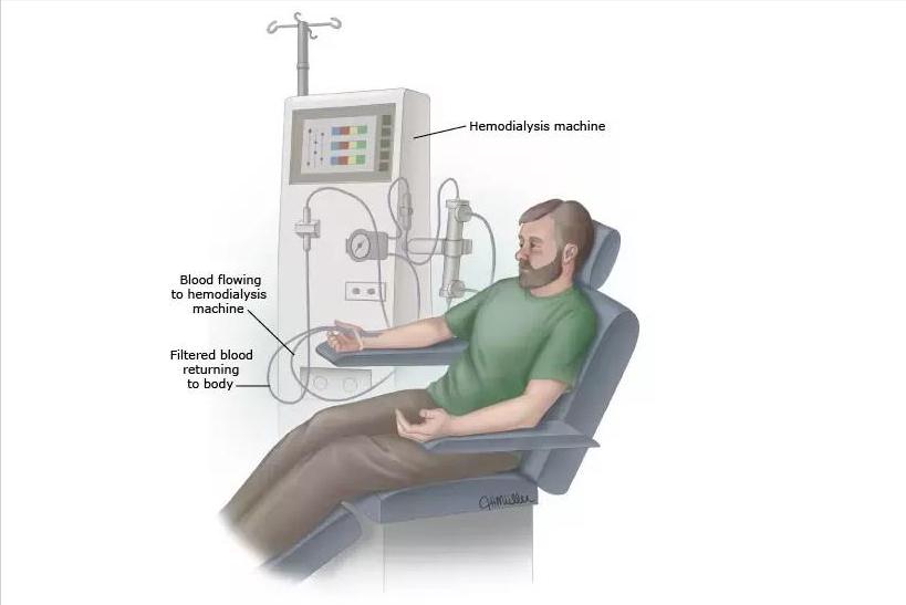 类风湿最有效的理疗方法,治类风湿用免疫吸附能调节免疫吗
