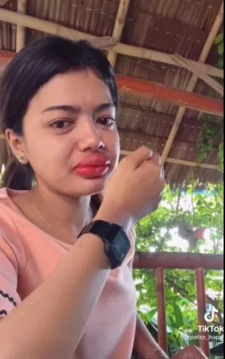 笑不活了女教师纹唇导致嘴唇过度“丰满”