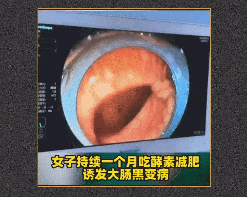 当心这五款网红零食千万别吃了,网红零食你们吃过几种