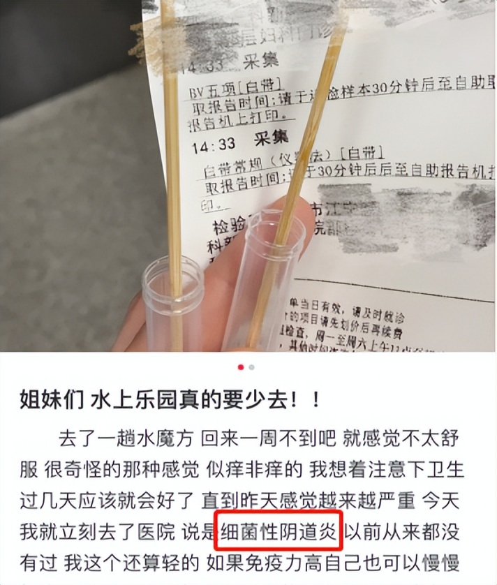想去游泳馆游泳又怕水脏,想去游泳但是都说泳池很脏怎么办