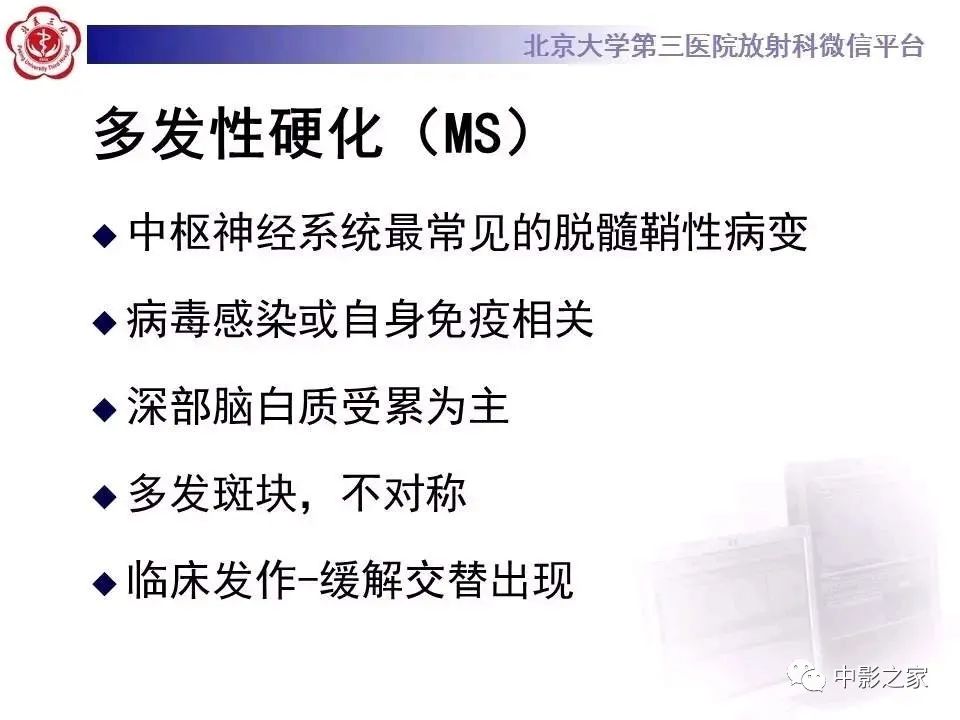 什么叫原发性胼胝体变性,原发性胼胝体变性治疗多少钱
