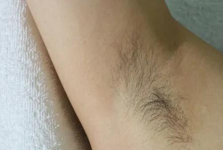 女性思想病态化,女性如何处理生理性毛发