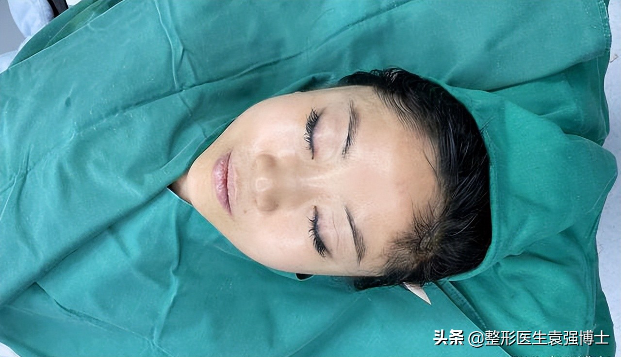 45岁做拉皮多少钱,北京做大拉皮前后对比照片图文