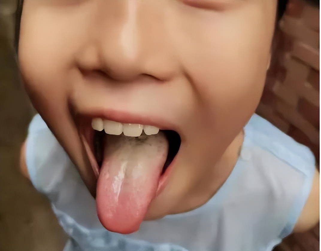 孩子反复咳嗽，支气管炎，脾胃不调，吃再多抗生素都白搭