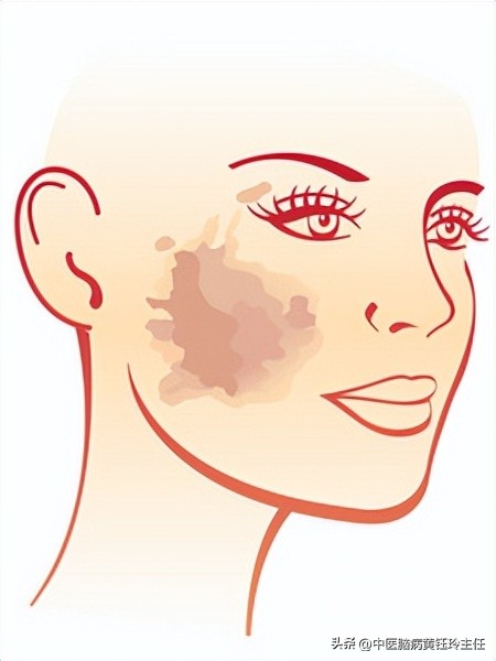 针灸美容祛皱效果好吗视频,面部针灸美容哪些部位有效
