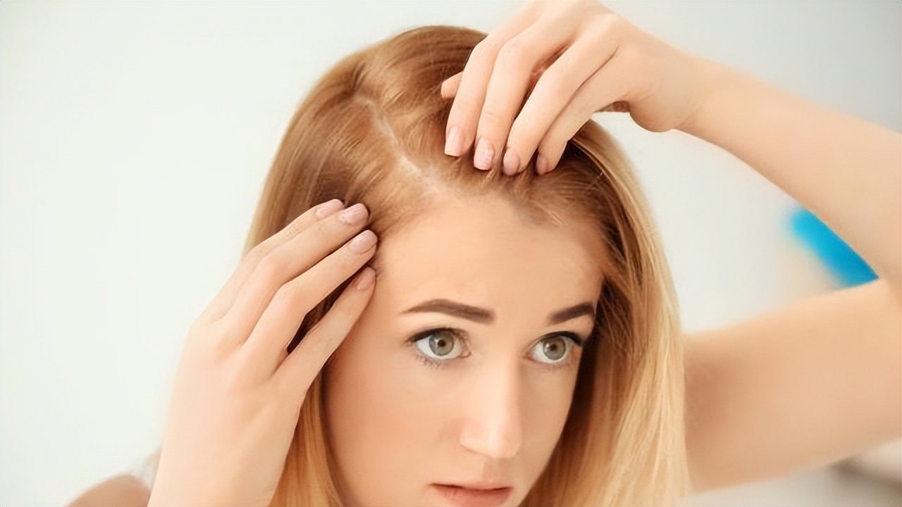 头皮屑特别多你该怎么治,头皮屑多有什么解决方法吗