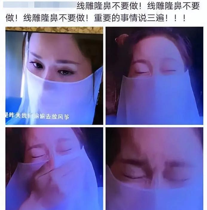 娱乐圈天然脸vs整容脸,娱乐圈没有整容的人纯天然的脸