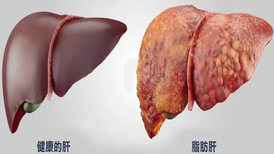 五十岁男人雄激素减少怎么办,男60岁后雄激素依然旺盛好吗