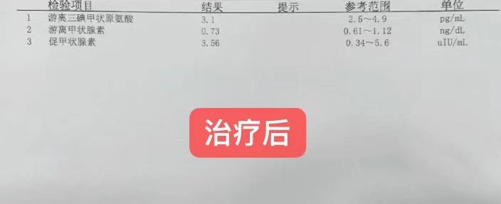 做了碘131出现甲减的几率有多大,碘131后甲减那么可怕吗