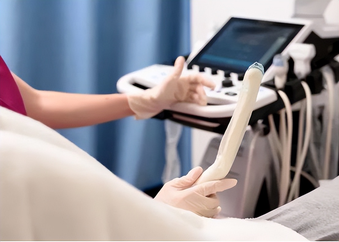 “裤子脱了腿张开”，医院里让人脸红的妇科检查，你做过几个？