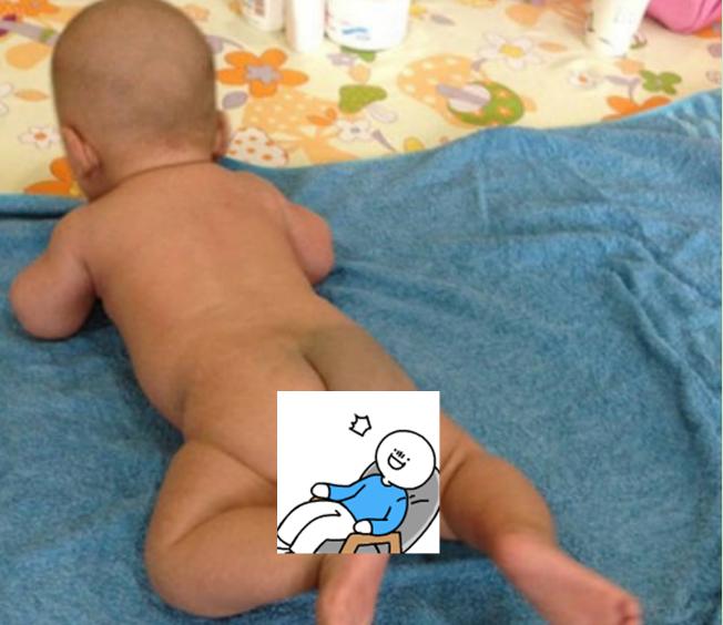 大部分宝宝屁股发青,和“前世”有啥关系?来了解这些原因