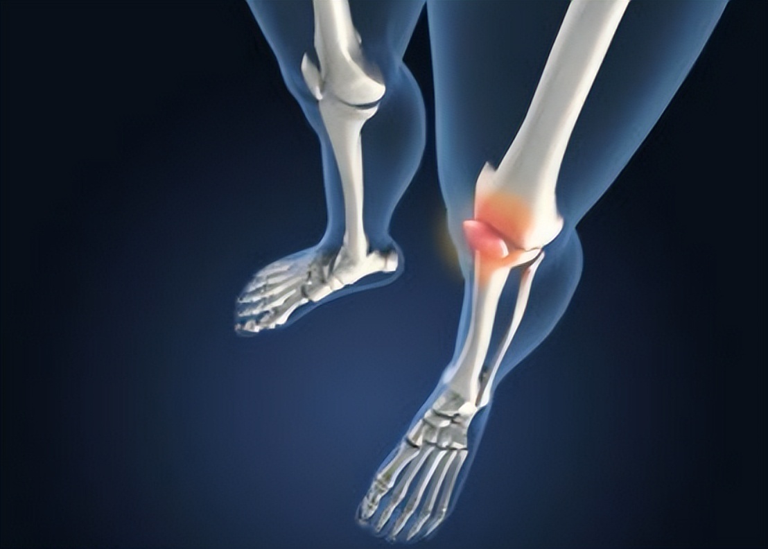 腐乳是人间美味还是健康杀手,腐乳到底是人间美味还是健康的