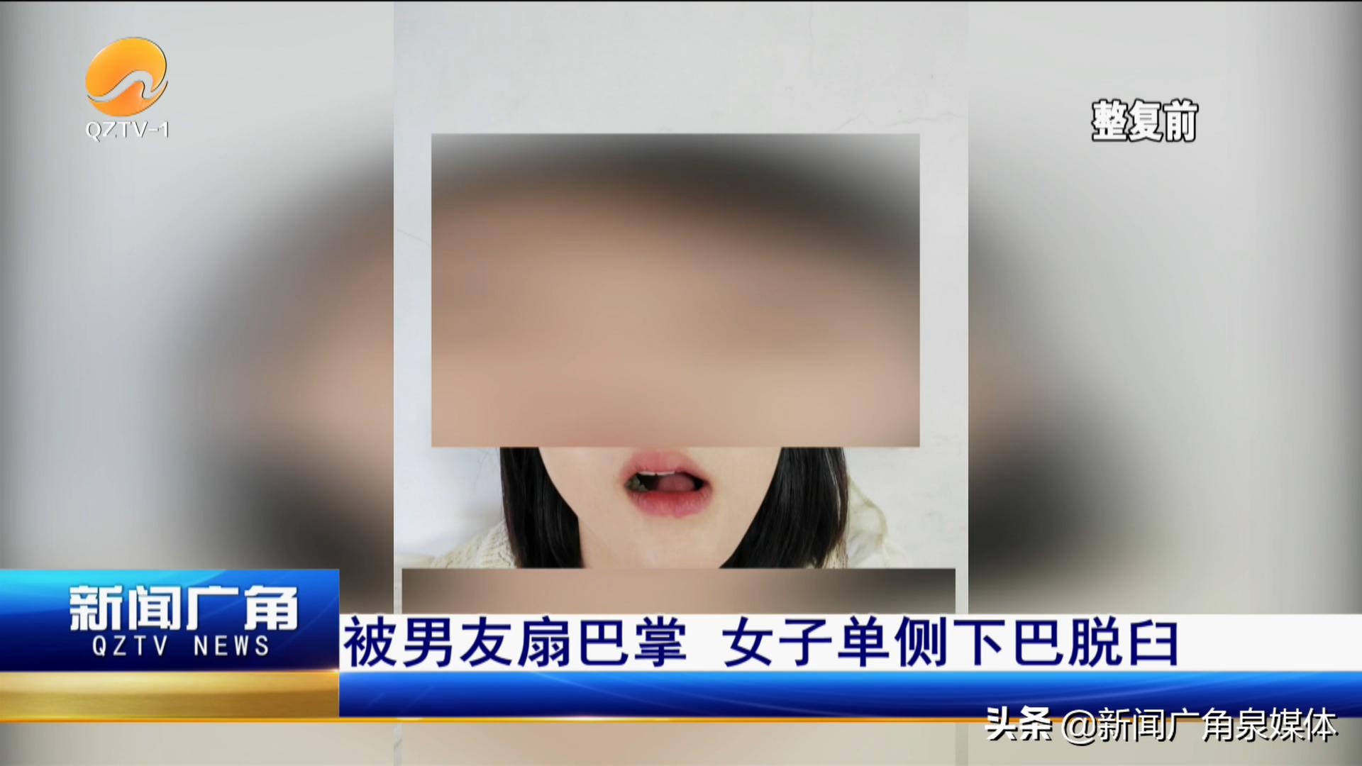 核酸采样咽拭子掉落,核酸采样口腔拭子折断位置