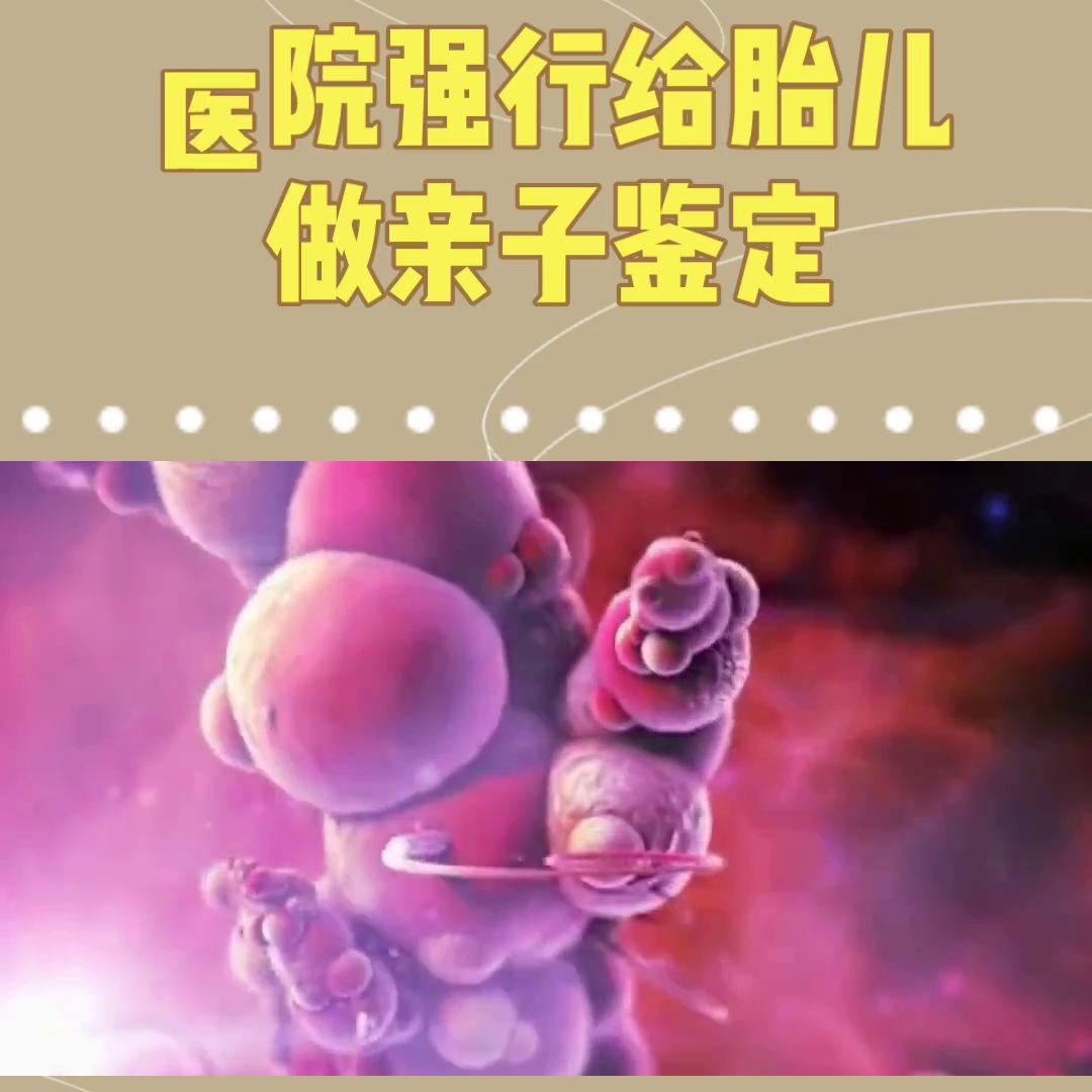 用一部手机剪辑的短视频制作灬展开灬