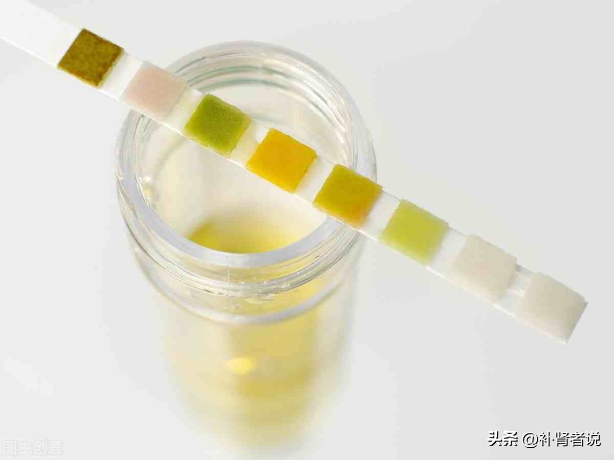 尿隐血是怎么回事1+要紧吗,尿隐血是怎么回事知乎