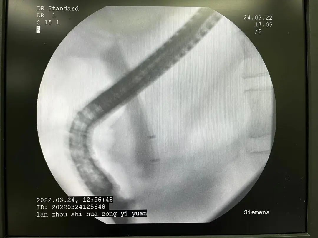 内镜新技术,乳腺外科新技术新项目