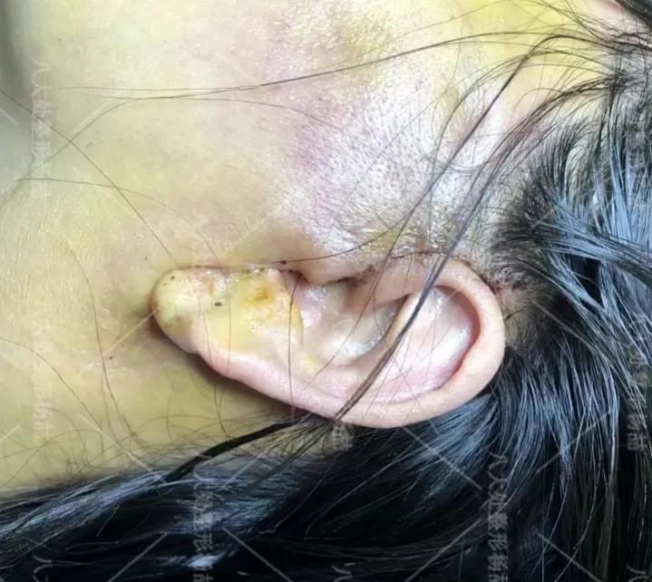 八大处医院杨喆抖音,八大处整形医院杨喆